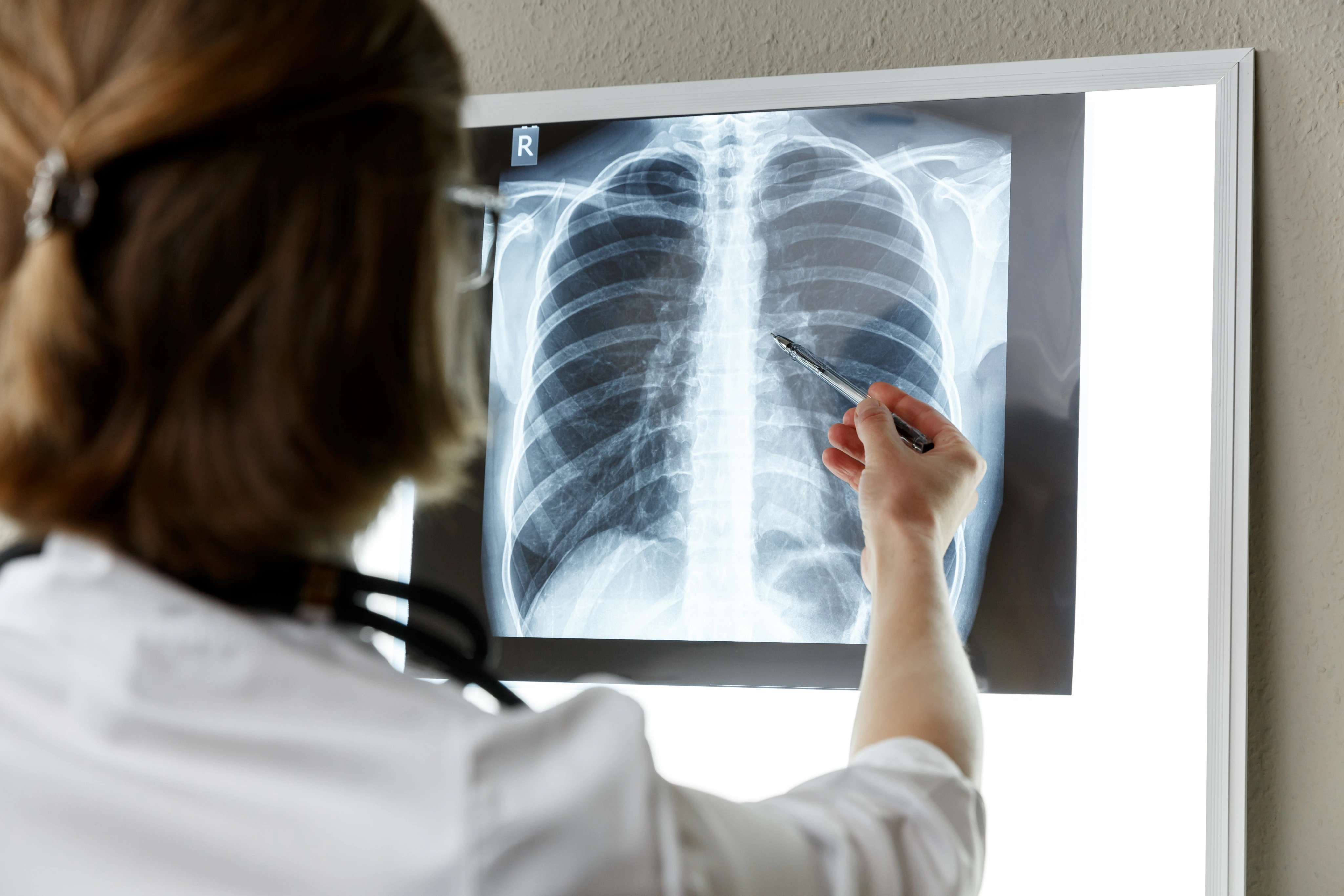 Radiografia del torace osservata da un medico